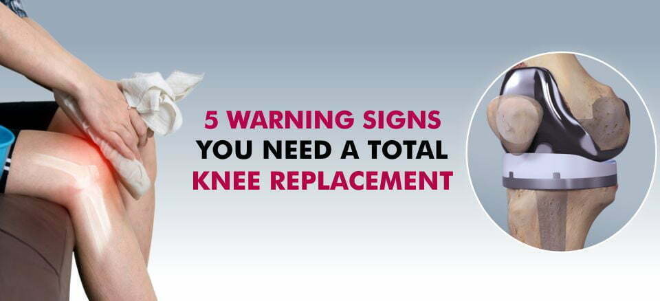 5-Warning-signs-you-need-a-total-knee-replacement